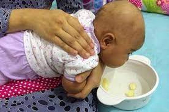 cara mengeluarkan dahak pada bayi
